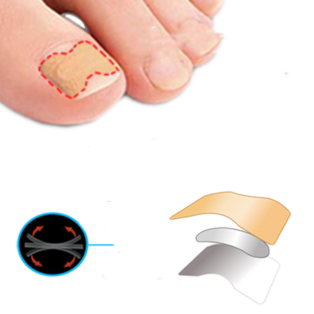 Inlay Nail Paste Double-sided Tape Inlay Nail Corrector Tool