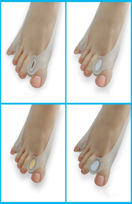 Adjustable Toe Separation Corrector For Hallux Valgus
