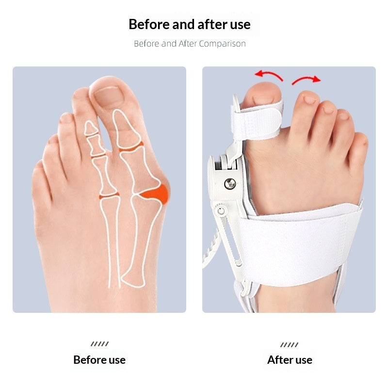 Bunion Corrector Overlapping Toe Separator Day And Night Adjustable Buckle Toe Corrector